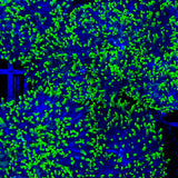 Green Hairy Mushroom Coral