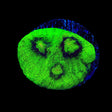 Vivids Riddler Chalice Coral