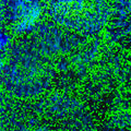 Green Hairy Mushroom Coral