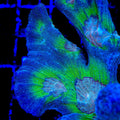 TSA Sizzler Pectinia Coral