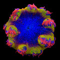 Ultra Rock Flower Anemone