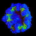 Ultra Rock Flower Anemone